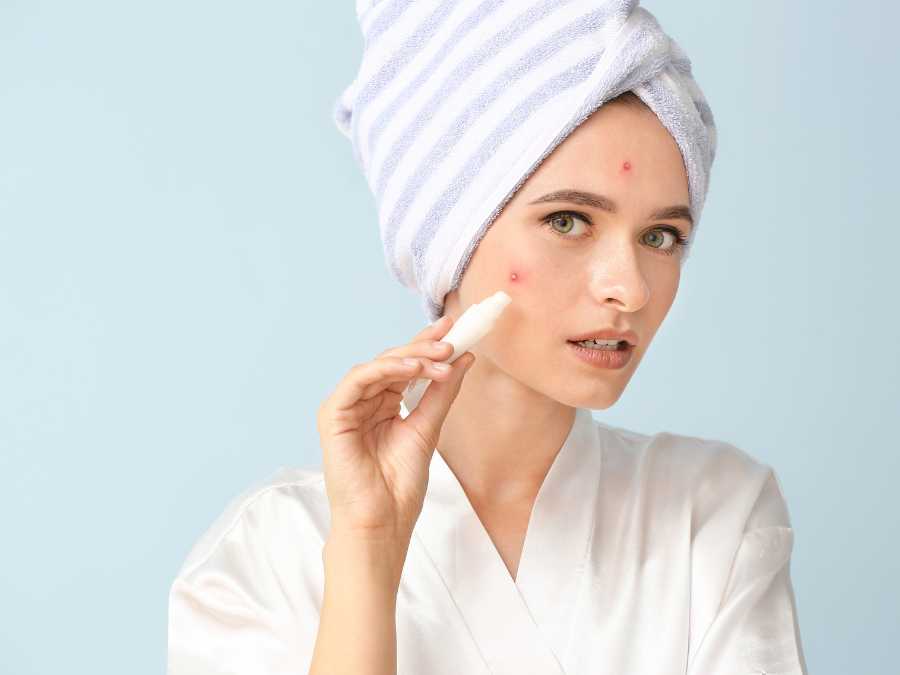 spot-treatment-postpartum-summer-skincare-routing