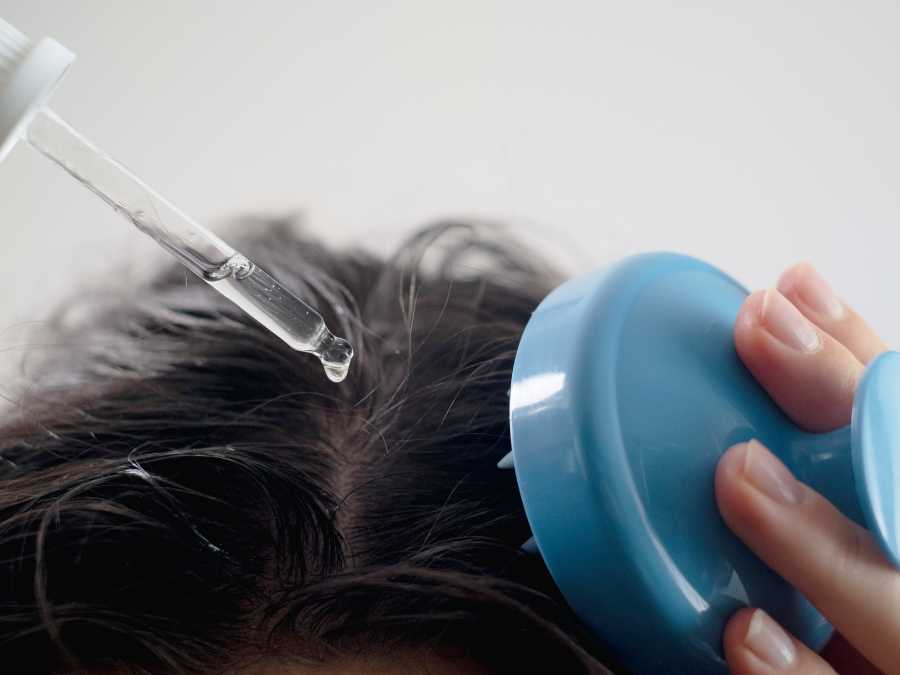 healthy-scalp-best-hair-growth-tip