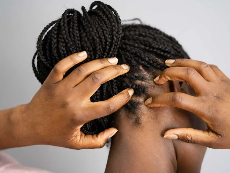 give-your-sclap-a-gentle-massage,winter-hair-braid-ideas