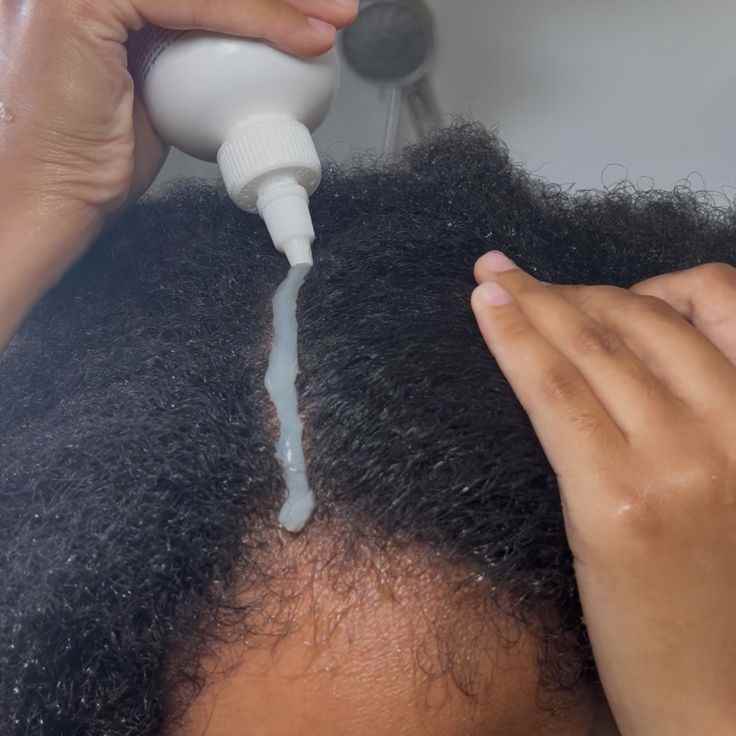 moisturize-the-scalp-regularly
